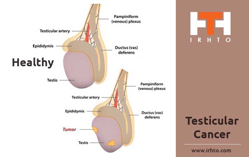 In almost all cases, you'll need further tests to check whether testic...