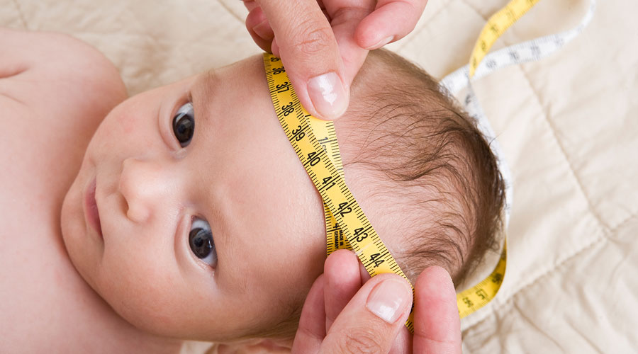 Hydrocephalus