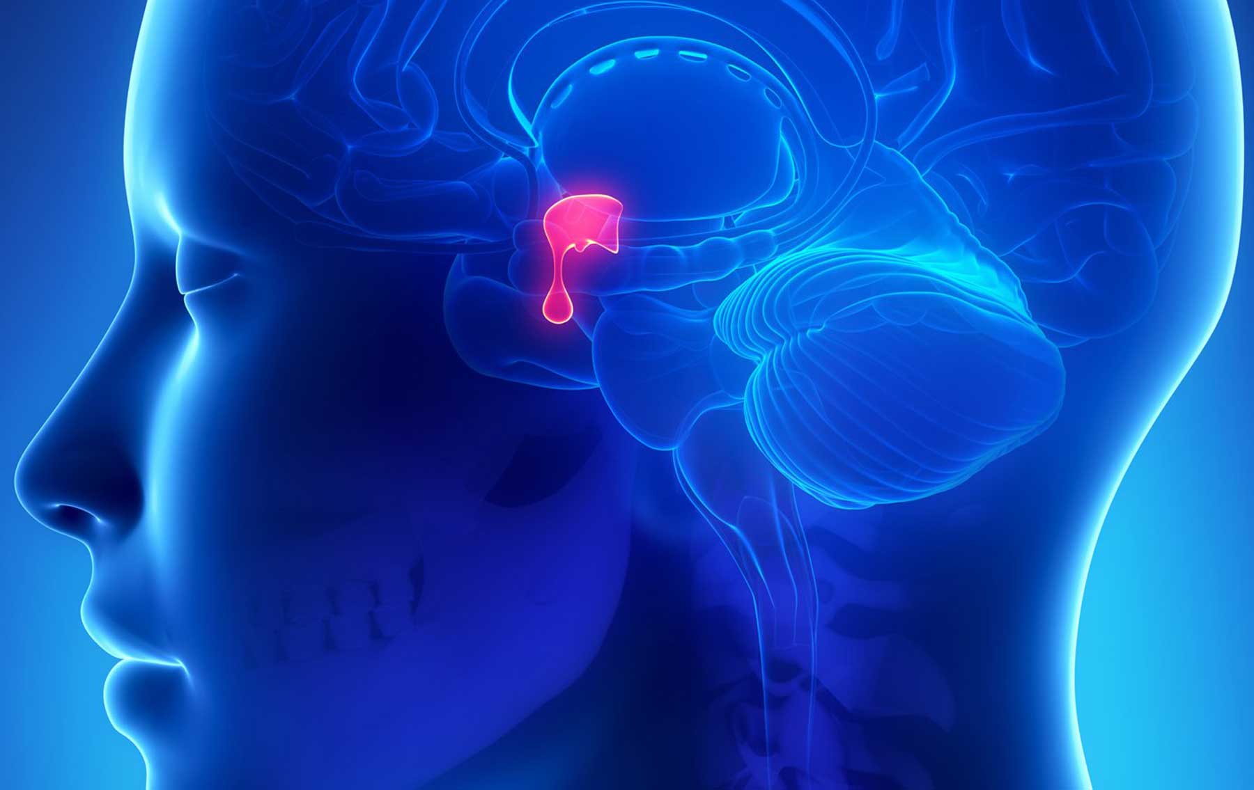 Pituitary Tumors