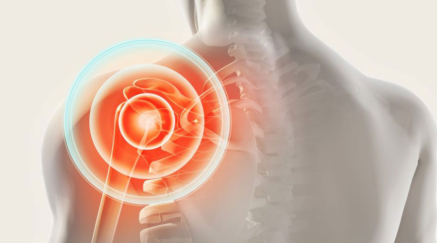 Rotator Cuff Injury