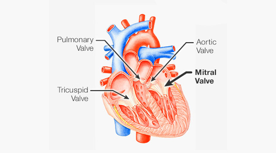 Mitral Valve Prolapse - IRAN Health Tourism Organizer - Iran Medical ...