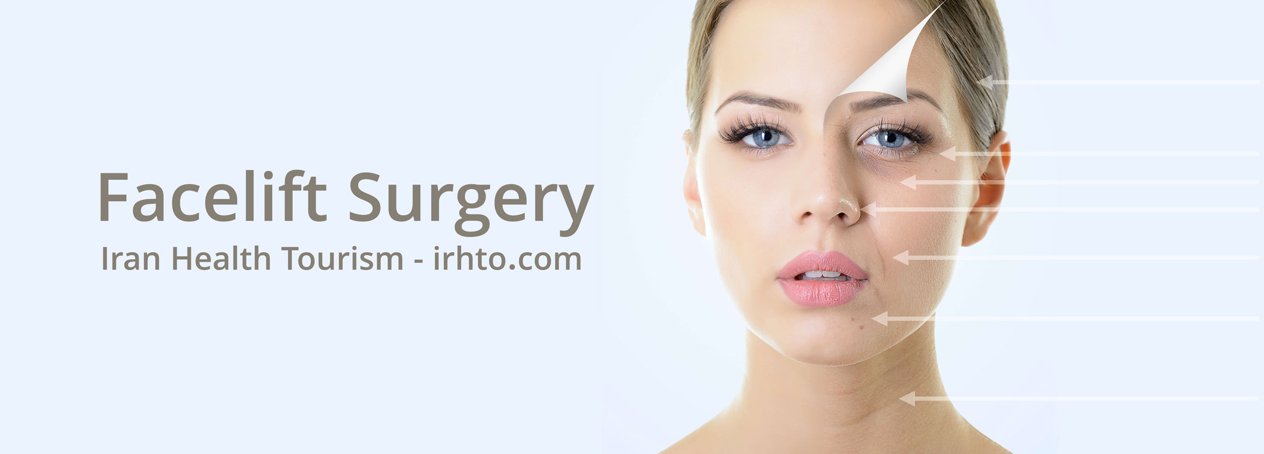 Facelift Surgery